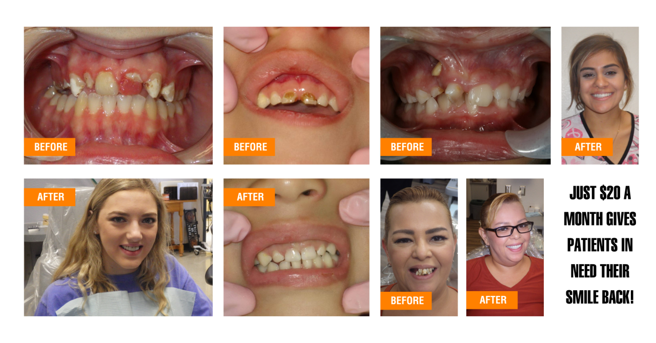 Grid with before and after photos from the SVdP dental clinic